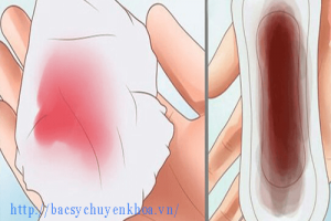 [Giải đáp] Kinh nguyệt màu đen là bệnh gì: Nguy hiểm không và uống thuốc gì?