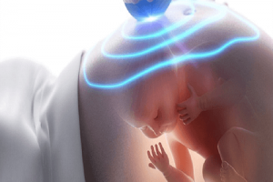 [Hỏi đáp] Siêu âm nhiều có tốt không? câu trả lời chính xác nhất là đây!