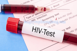 [Tổng hợp 2020] Xét nghiệm Hiv bao lâu có kết quả và khi nào nên xét nghiệm Hiv?