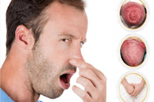 [ Bật mý ] 5 nguyên nhân khiến dương vật có mùi hôi và cách xử lý hiệu quả!