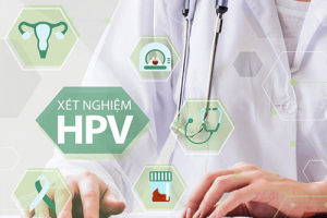 Xét nghiệm HPV giá bao nhiêu và bảng giá mới cập nhật [2020]