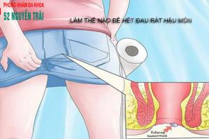Tại sao nhiều người gặp phải tình trạng đau rát hậu môn?